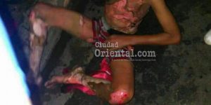 Una de las últimas fotos que le hicieron al adolescente tras ser quemado vivo por dos mujeres.