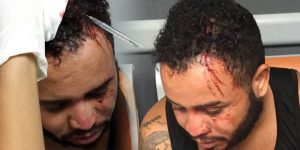 Edwin Reyes Caraballo es curado de la herida que le provocaron en la acbeza empleados del ASDE con la culata de una escopeta.
